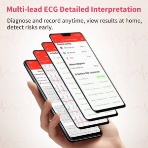 CFY E02 Multi-Lead ECG Monitoring Blood Glucose Blood Pressure Heart Rate Measurement Health Smart Watch