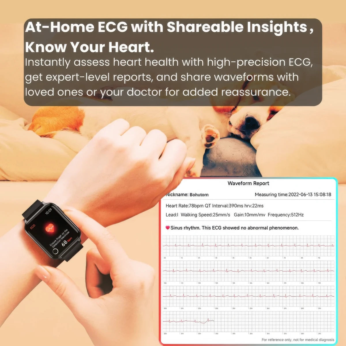 CFY E108 ECG Smartwatch With Blood Oxygen Heart Rate Monitor Sleep Monitoring