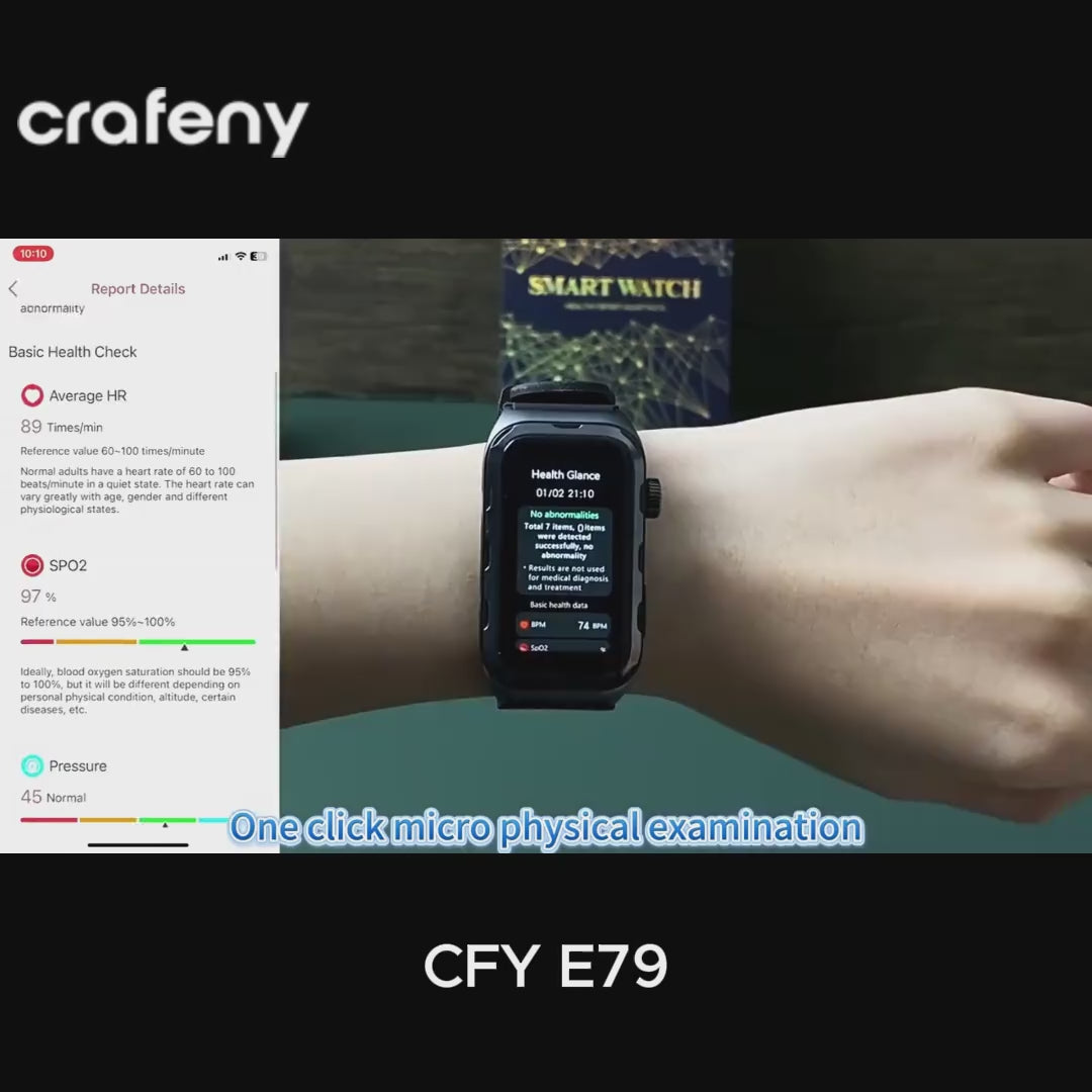 CFY E79 ECG Blood Sugar Smart Watch